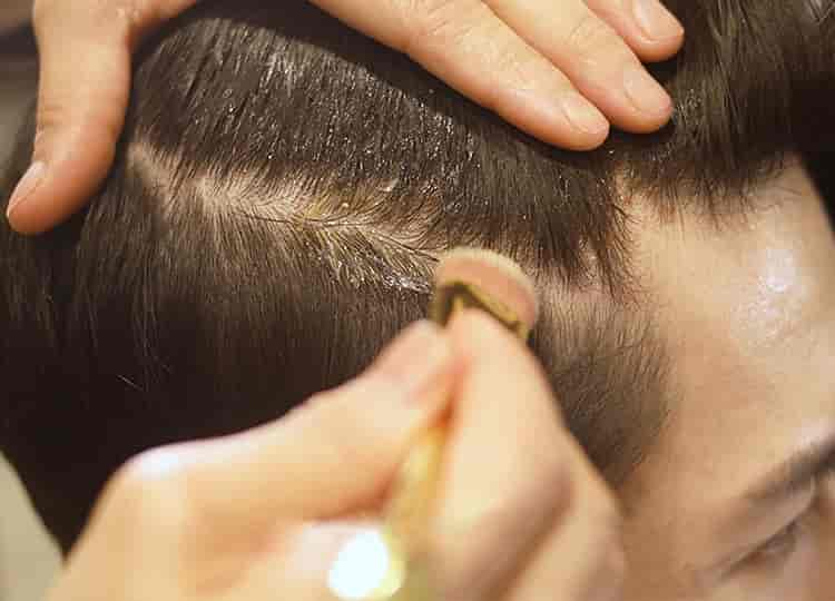 Customised Scalp Treatment Trial at SGD 58