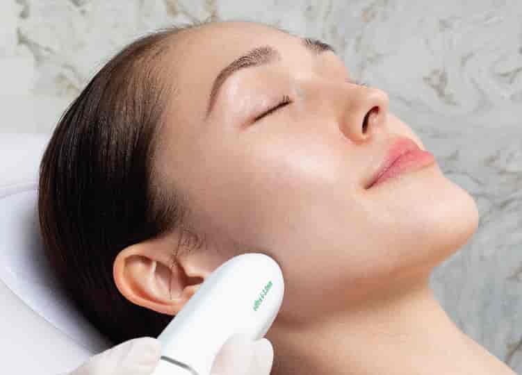 HIFU Face Lift - First Time Trial
