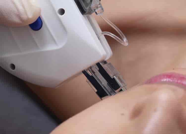 Dermashine Skin Boosters - First Time Trial
