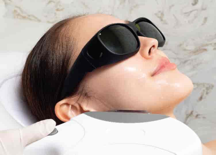AlmaLASE Laser Facial 3 Sessions First Time Trial